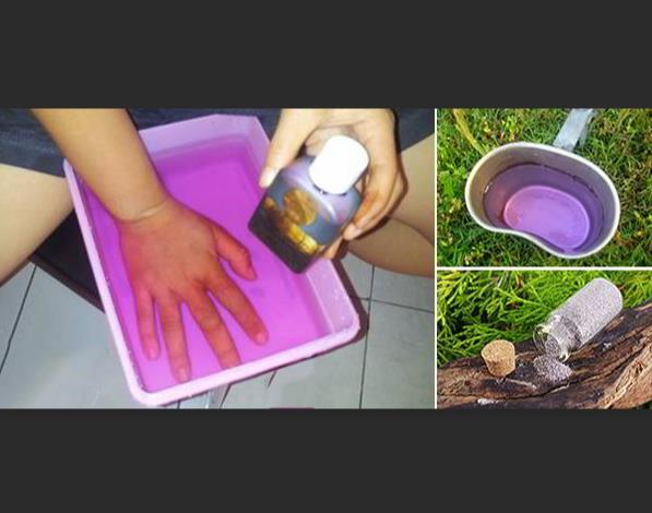 高錳酸鉀的醫(yī)療效果圖